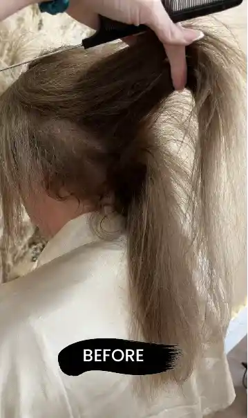 Before results for Vicky